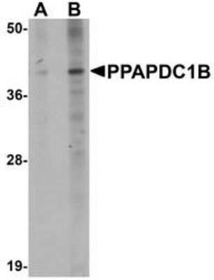 Western Blot: PPAPDC1B/DPPL1 AntibodyBSA Free [NBP1-76244]