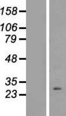 Western Blot: PPAPDC1B/DPPL1 Overexpression Lysate [NBL1-14628]