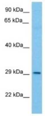 Western Blot: PPAPDC3 Antibody [NBP3-10195]