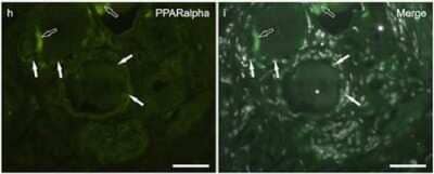 Immunohistochemistry: PPAR alpha/NR1C1 Antibody - N-terminal [NB600-636]