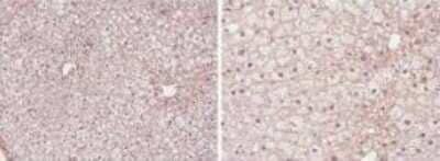 Immunohistochemistry-Paraffin: PPAR alpha/NR1C1 Antibody - N-terminal [NB600-636]