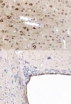 Immunohistochemistry-Paraffin: PPAR alpha/NR1C1 Antibody - N-terminal [NB600-636]