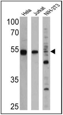 Western Blot: PPAR alpha/NR1C1 Antibody (3B6/PPAR)BSA Free [NB300-537]
