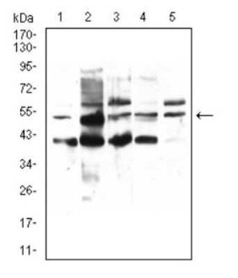 Western Blot: PPAR alpha/NR1C1 Antibody (5D10C3)BSA Free [NBP2-52538]