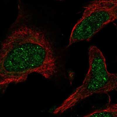 Immunocytochemistry/ Immunofluorescence: PPAR alpha/NR1C1 Antibody [NBP2-57777]
