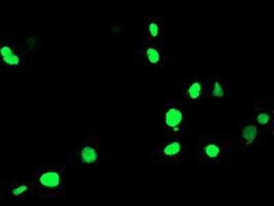 Immunocytochemistry/ Immunofluorescence: PPAR alpha/NR1C1 Antibody (OTI1E8) - Azide and BSA Free [NBP2-73567]