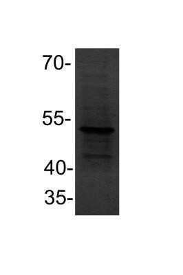 Western Blot: PPAR alpha/NR1C1 Antibody (OTI1E8)Azide and BSA Free [NBP2-73567]