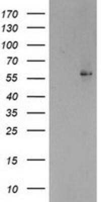 Western Blot: PPAR alpha/NR1C1 Antibody (OTI1E8)Azide and BSA Free [NBP2-73567]