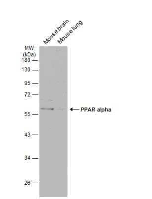 Western Blot: PPAR alpha/NR1C1 Antibody [NBP1-31834]