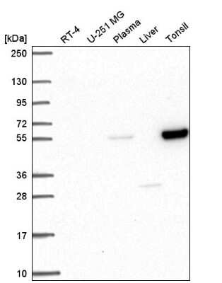 Western Blot: PPAR alpha/NR1C1 Antibody [NBP2-57777]