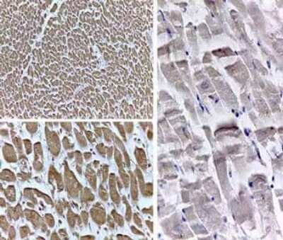 Immunohistochemistry: PPAR delta/NR1C2 Antibody - N-terminal [NB600-637]