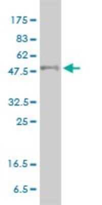 Western Blot: PPAR delta/NR1C2 Antibody (4E3-1B11) [H00005467-M01]