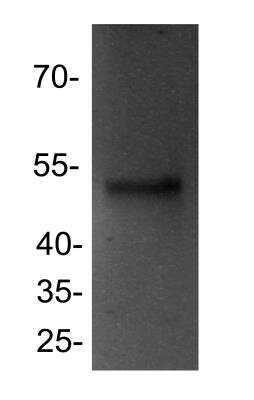 Western Blot: PPAR delta/NR1C2 Antibody [NB300-962]