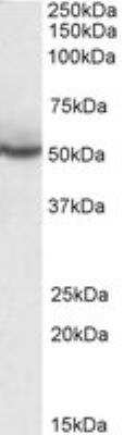 Western Blot: PPAR delta/NR1C2 Antibody [NB300-962]