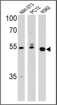 Western Blot: PPAR delta/NR1C2 Antibody [NBP2-22468]