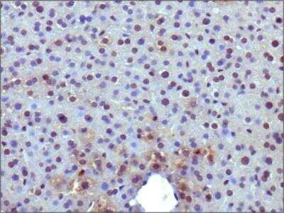 Immunohistochemistry-Paraffin: PPAR gamma/NR1C3 Antibody - BSA Free [NBP2-22106]