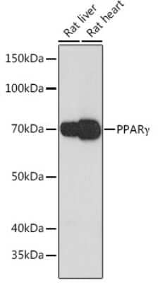 Western Blot: PPAR gamma/NR1C3 Antibody (9P1J6) [NBP3-15853]