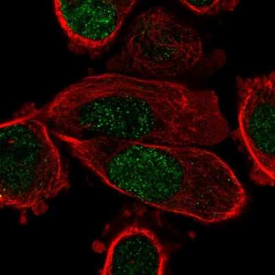 Immunocytochemistry/ Immunofluorescence: PPAR gamma/NR1C3 Antibody [NBP2-56194]