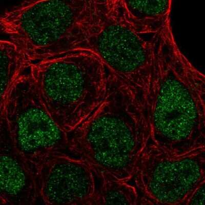 Immunocytochemistry/ Immunofluorescence: PPAR gamma/NR1C3 Antibody [NBP2-57833]