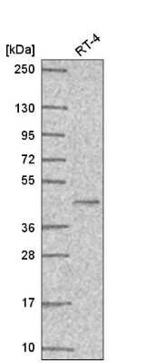 Western Blot: PPAR gamma/NR1C3 Antibody [NBP2-57833]