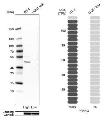 Western Blot: PPAR gamma/NR1C3 Antibody [NBP2-57833]