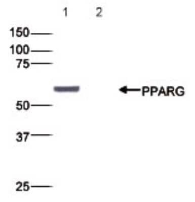 Western Blot: PPAR gamma/NR1C3 Antibody [NBP2-59223]