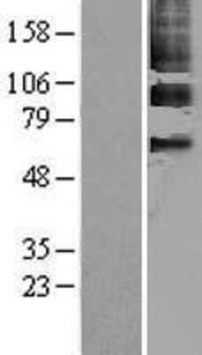 Western Blot: PPAR gamma/NR1C3 Overexpression Lysate [NBL1-14633]