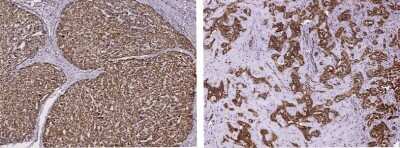 Immunohistochemistry: PPCDC Antibody [NBP3-00333]