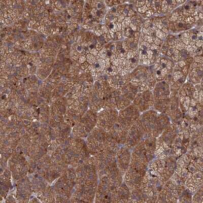 Immunohistochemistry-Paraffin: PPCDC Antibody [NBP2-13792]