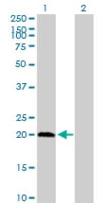 Western Blot: PPCDC Antibody [H00060490-B01P]