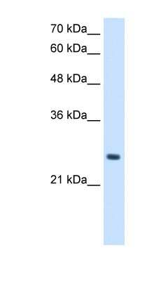 Western Blot: PPCDC Antibody [NBP1-56489]