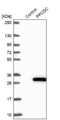 Western Blot: PPCDC Antibody [NBP2-13792]