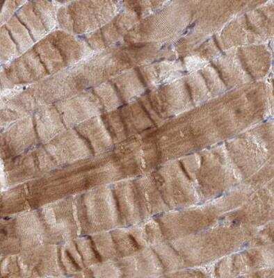 Immunohistochemistry-Paraffin: PPDPFL Antibody [NBP2-31818]