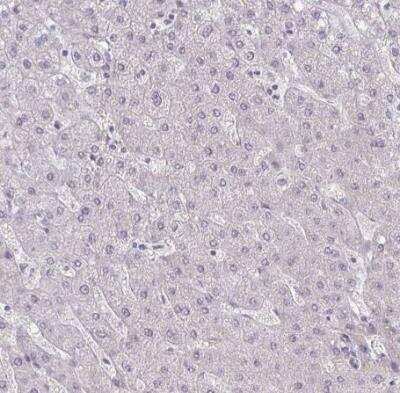 Immunohistochemistry-Paraffin: PPDPFL Antibody [NBP2-31818]