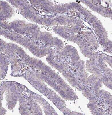 Immunohistochemistry-Paraffin: PPDPFL Antibody [NBP2-31818]