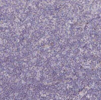 Immunohistochemistry-Paraffin: PPDPFL Antibody [NBP2-31818]