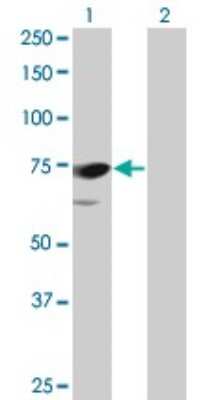 Western Blot: PPEF1 Antibody (1F6-1A5) [H00005475-M01]