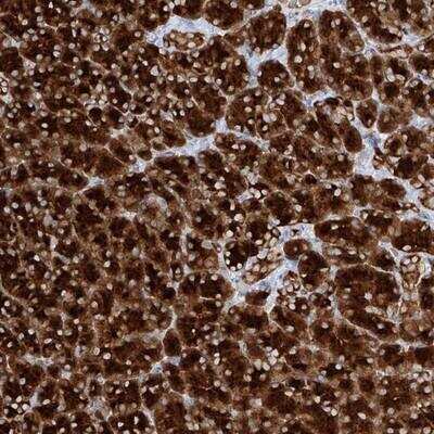 Immunohistochemistry-Paraffin: PPEF1 Antibody [NBP1-87239]