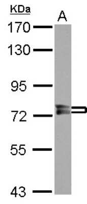 Western Blot: PPEF1 Antibody [NBP2-19897]