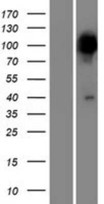 Western Blot: PPEF2 Overexpression Lysate [NBP2-07652]