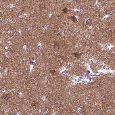 Immunohistochemistry: PPFIA3 Antibody [NBP2-30453]