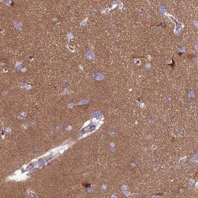 Immunohistochemistry-Paraffin: PPFIA3 Antibody [NBP2-30453]