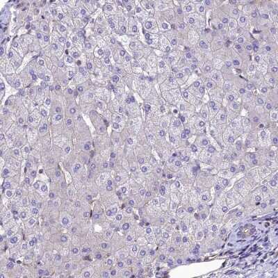 Immunohistochemistry-Paraffin: PPFIA3 Antibody [NBP2-30453]