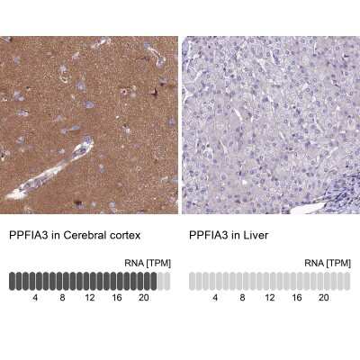 Immunohistochemistry-Paraffin: PPFIA3 Antibody [NBP2-30453]