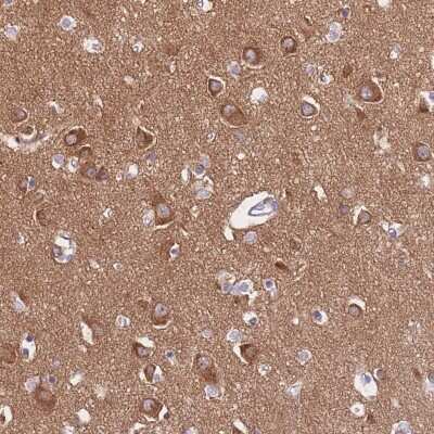 Immunohistochemistry-Paraffin: PPFIA3 Antibody [NBP2-30461]