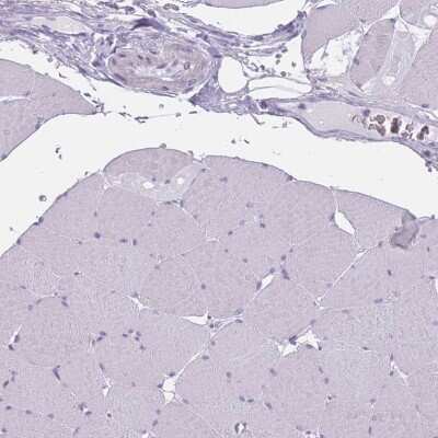 Immunohistochemistry-Paraffin: PPFIA3 Antibody [NBP2-30461]