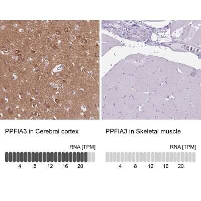 Immunohistochemistry-Paraffin: PPFIA3 Antibody [NBP2-30461]