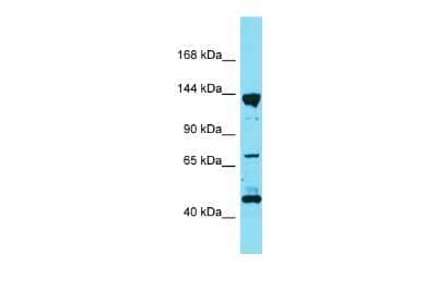 Western Blot: PPFIA3 Antibody [NBP2-85513]