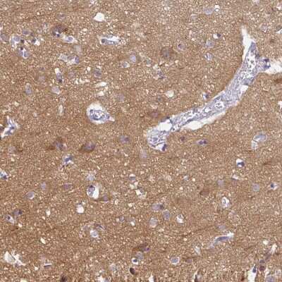 Immunohistochemistry: PPFIA4 Antibody [NBP2-31573]