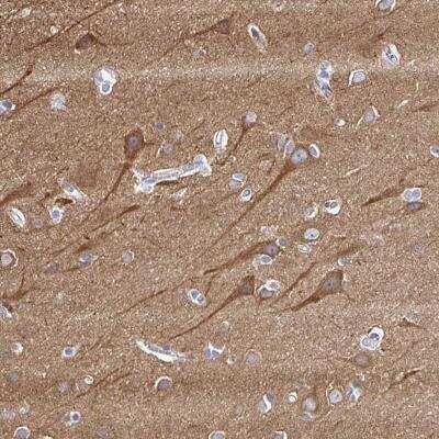 Immunohistochemistry-Paraffin: PPFIA4 Antibody [NBP2-31560]